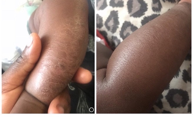 No More Itchy Skin Salve