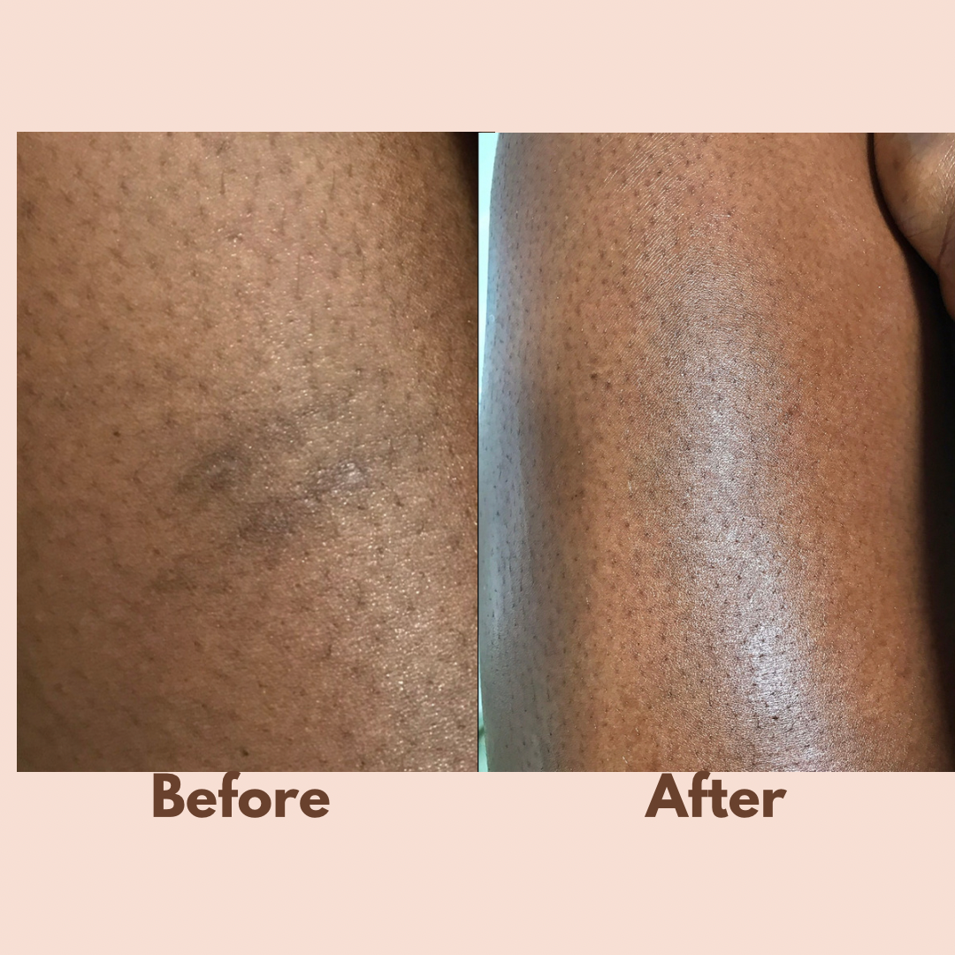 Turmeric Pamper Bundle (6 Skin Rejuvenating Products for A LOT LESS!!)