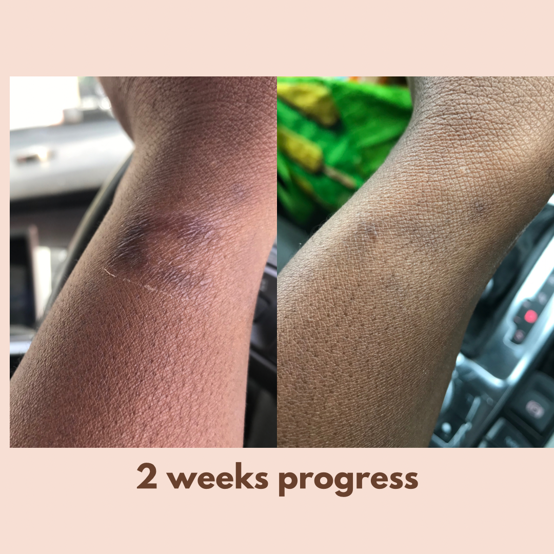 Turmeric Pamper Bundle (6 Skin Rejuvenating Products for A LOT LESS!!)