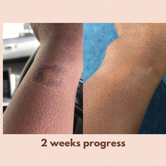 Fade Cream (Alpha Arbutin + Kojic Acid + Hyaluronic Acid)