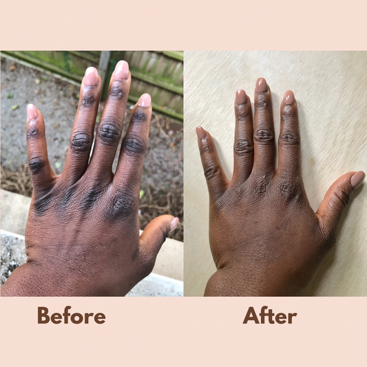 Turmeric Pamper Bundle (6 Skin Rejuvenating Products for A LOT LESS!!)