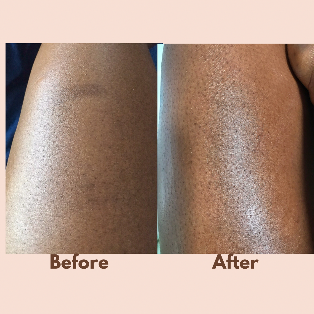 Turmeric Pamper Bundle (6 Skin Rejuvenating Products for A LOT LESS!!)